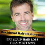 HAIR LOSS SOLUTIONS INCUDE PRP SCALP HAIR LOSS TREATMENT $949 (includes 4 NeoLTS Treatments)