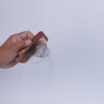 Hair loss in African American Women