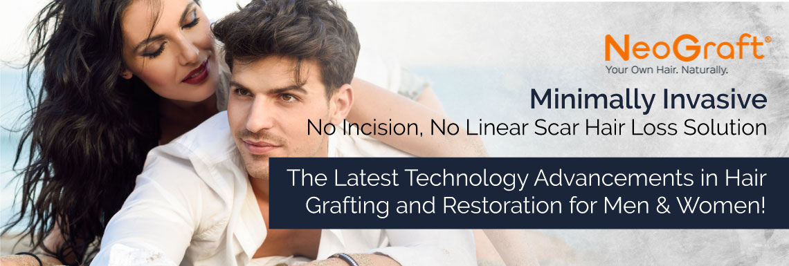 Neograft Hair Loss in men solutions