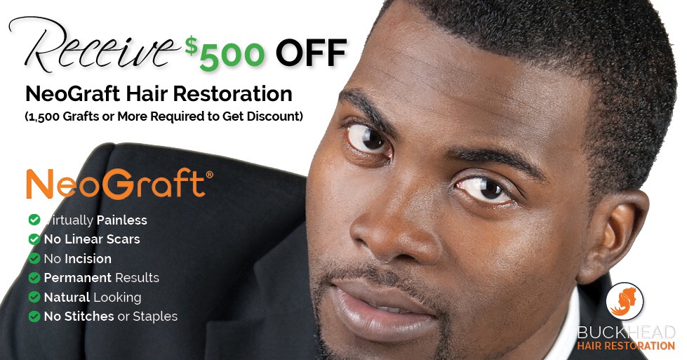 African American Hair Loss Solutions Buckhead Hair Restoration