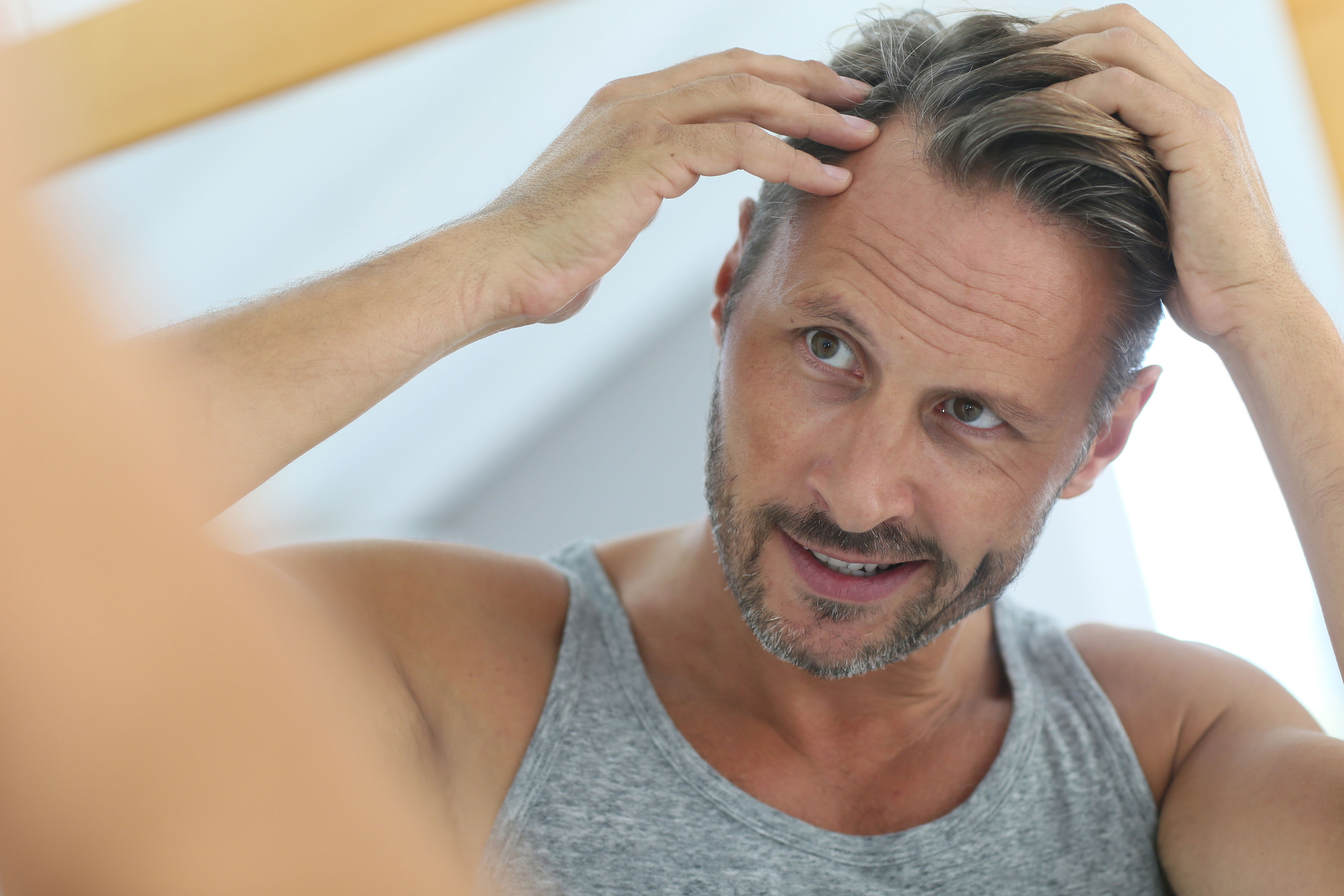 advanced hair transplant questions stress linked to hair loss