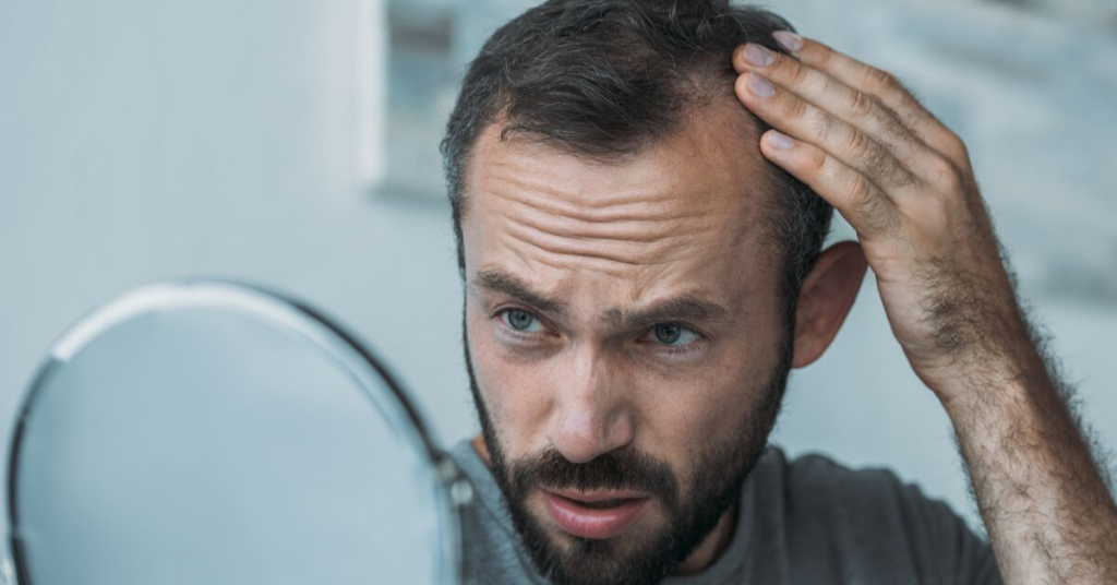 Seven Most Common Hair Loss Questions and Answers- HairLoss Solutions at Buckhead Hair Restoration in Atlanta and Warner Robins, Georgia