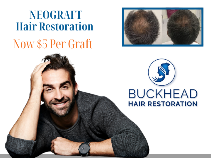 Neograft now only $5 per graft 