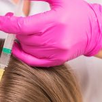 Best Non-Surgical Hair Restoration Treatments for Thinning Hair in Atlanta