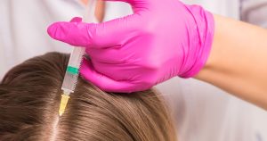 Best Non-Surgical Hair Restoration Treatments for Thinning Hair in Atlanta
