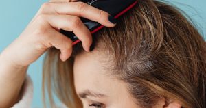 Best Non-Surgical Hair Restoration Treatments for Thinning Hair in Atlanta