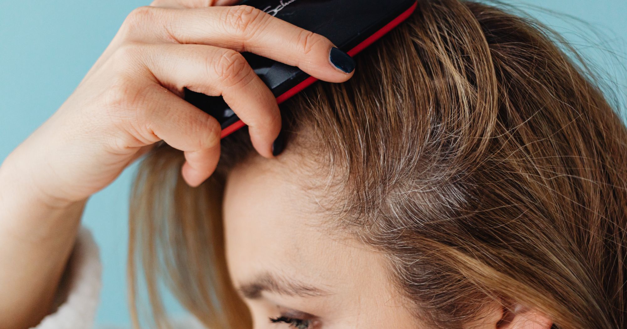 best-non-surgical-hair-restoration-treatments-for-thinning-hair-in-atlanta-3 Best Non-Surgical Hair Restoration Treatments for Thinning Hair in Atlanta