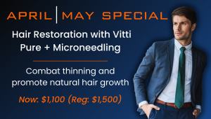 hair transplant atlanta