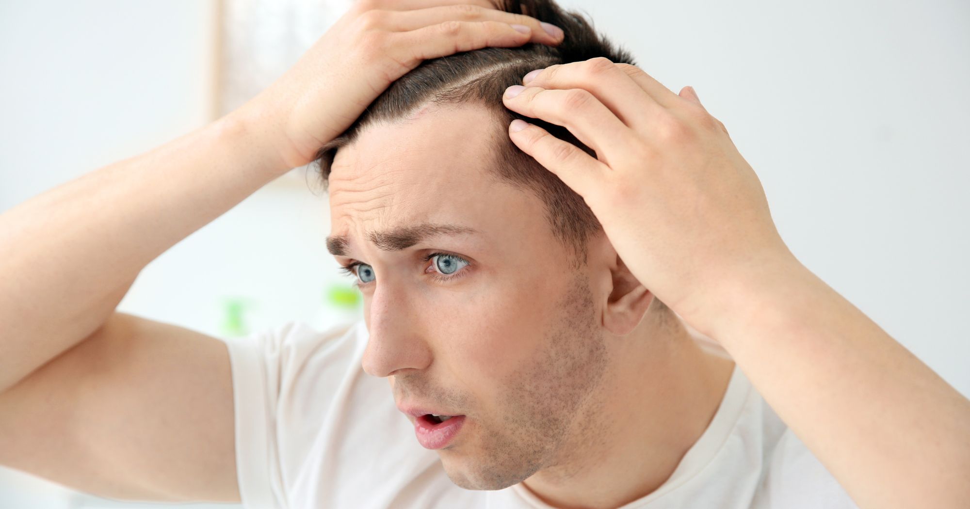 top-causes-of-hair-thinning-1 Top Causes of Hair Thinning