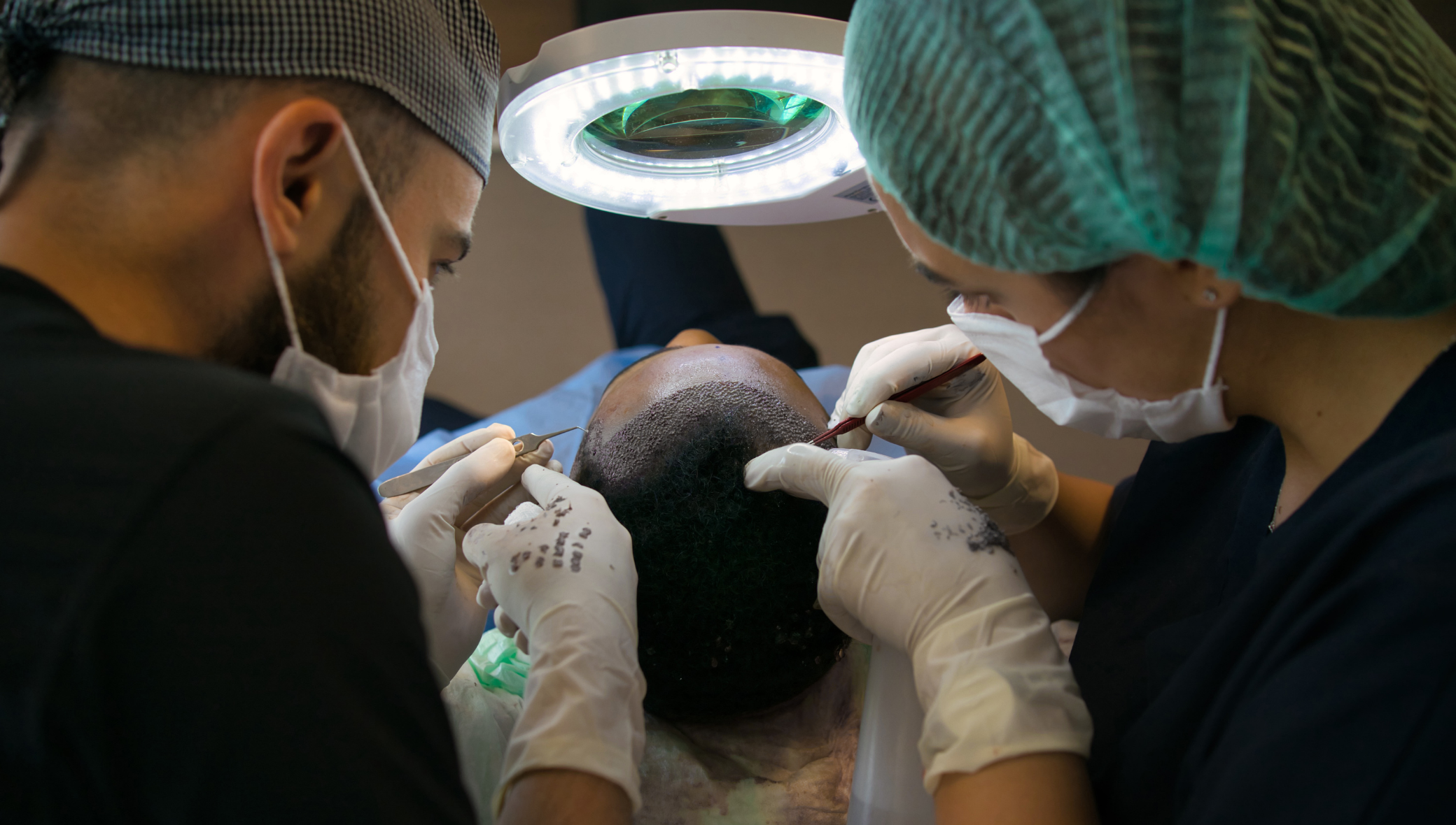 do-hair-transplants-hurt Do Hair Transplants Hurt