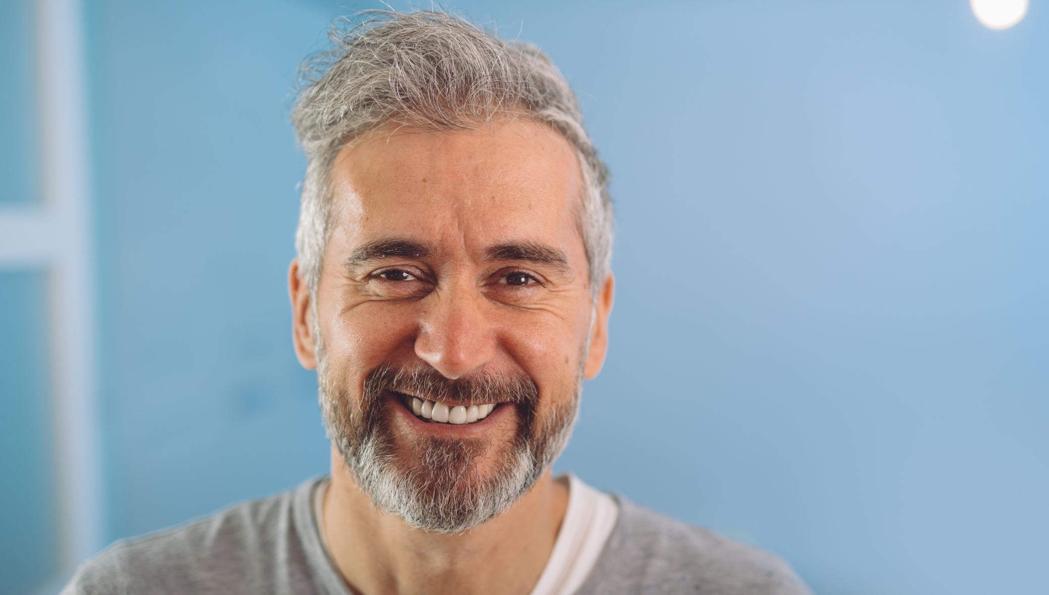 is-hair-transplant-covered-by-insurance-1 Is Hair Transplant Covered by Insurance?