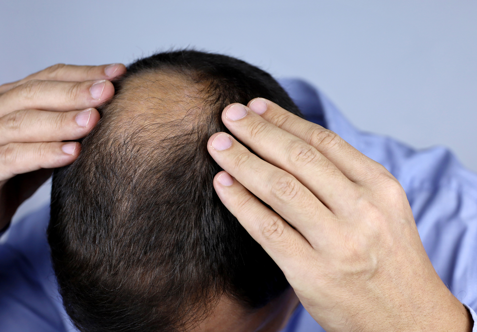 client-getting-hair-loss-consultation-in-atlanta-1 client getting hair loss consultation in atlanta