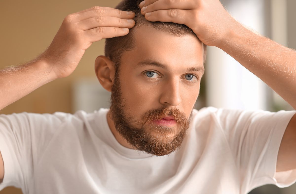 fue-hair-transplant FUE Hair Transplant