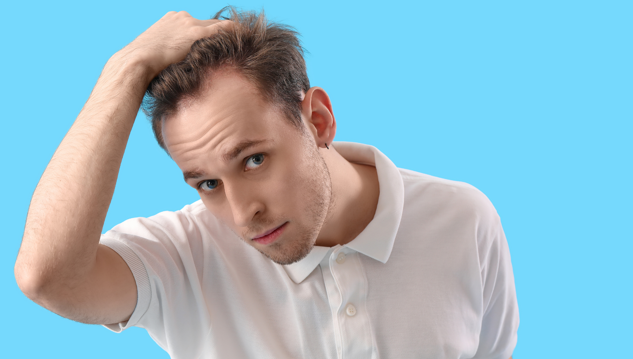 microneedling-for-hair-restoration-3 microneedling for hair restoration